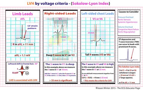 sokolov lyon diagnosis